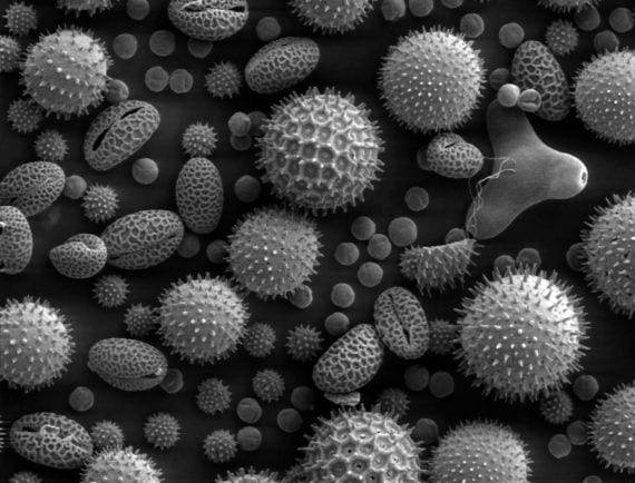 Granos de polen vistos al microscopio